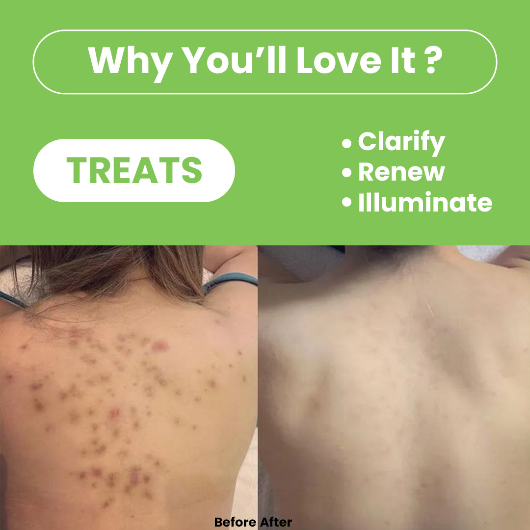 Green Tea Matcha Face & body Scrub | Vitamin C & Lactic Acid for Detan, Uneven Skin Tone & Skin Purification | 200gm