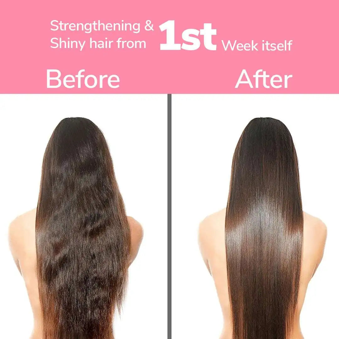 FreshLuxe Anti-Hairfall & Strengthening Combo | Rice Water & Onion Rosemary 200ml