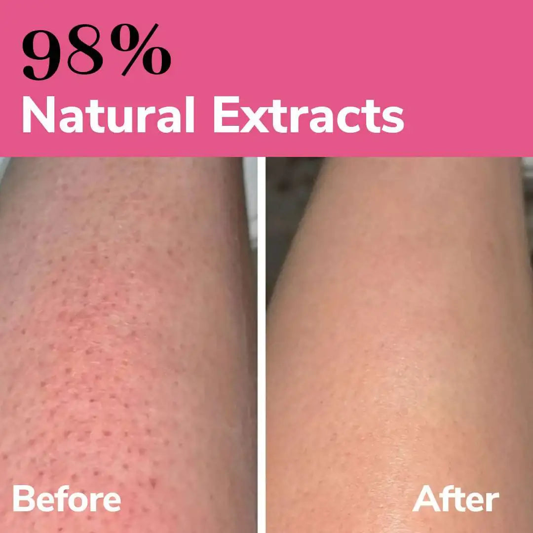 FreshLuxe Anti-Aging for Skin & Hair | AYUSH-Approved | Combo with Rice Water, Lactic Acid & Argan Oil 200ml