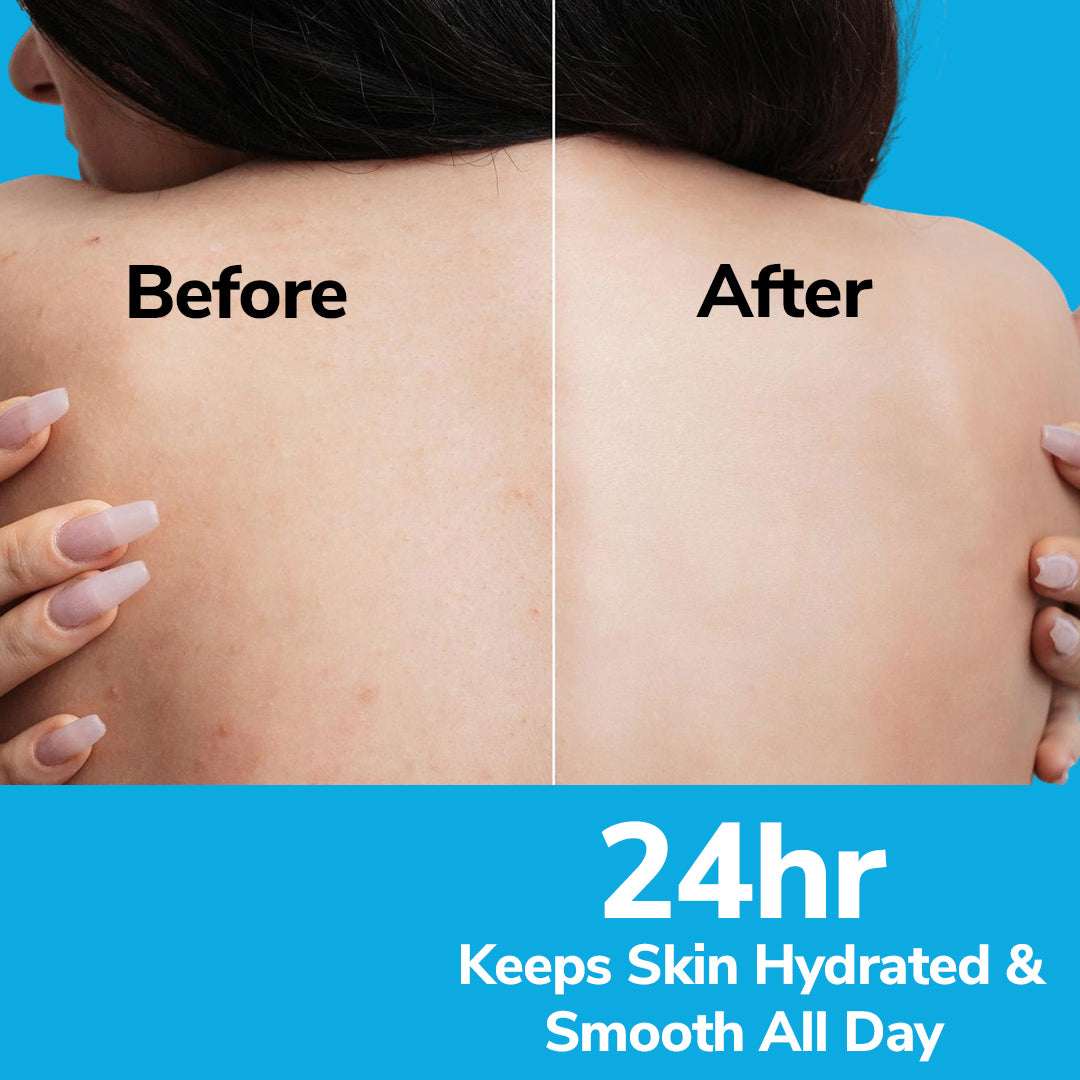 Before and after comparison of skin hydration on a person&