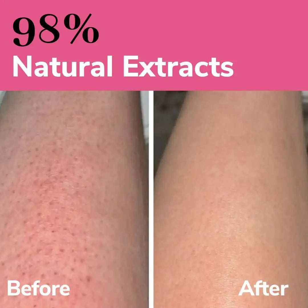 Dry Skin Combo β Deep Hydration & Nourishing Care Kit