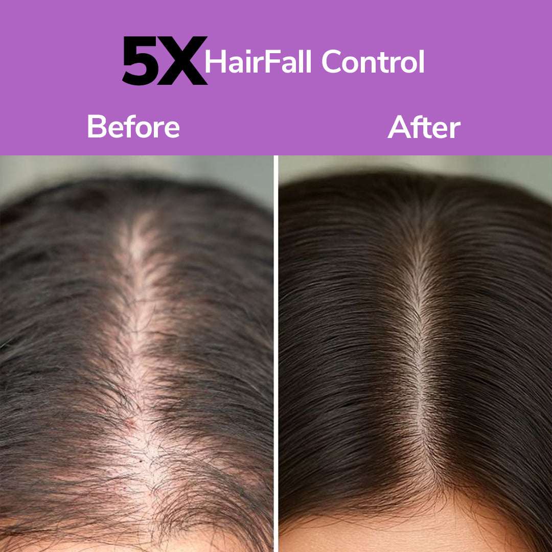 FreshLuxe Anti-Hairfall & Strengthening Combo | Rice Water & Onion Rosemary 200ml