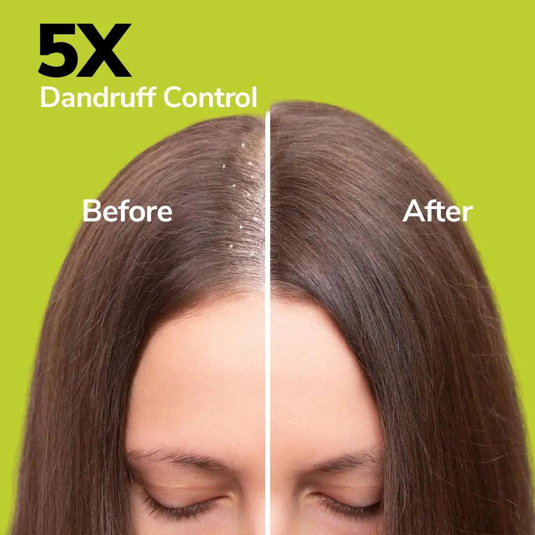 Anti-Dandruff Combo