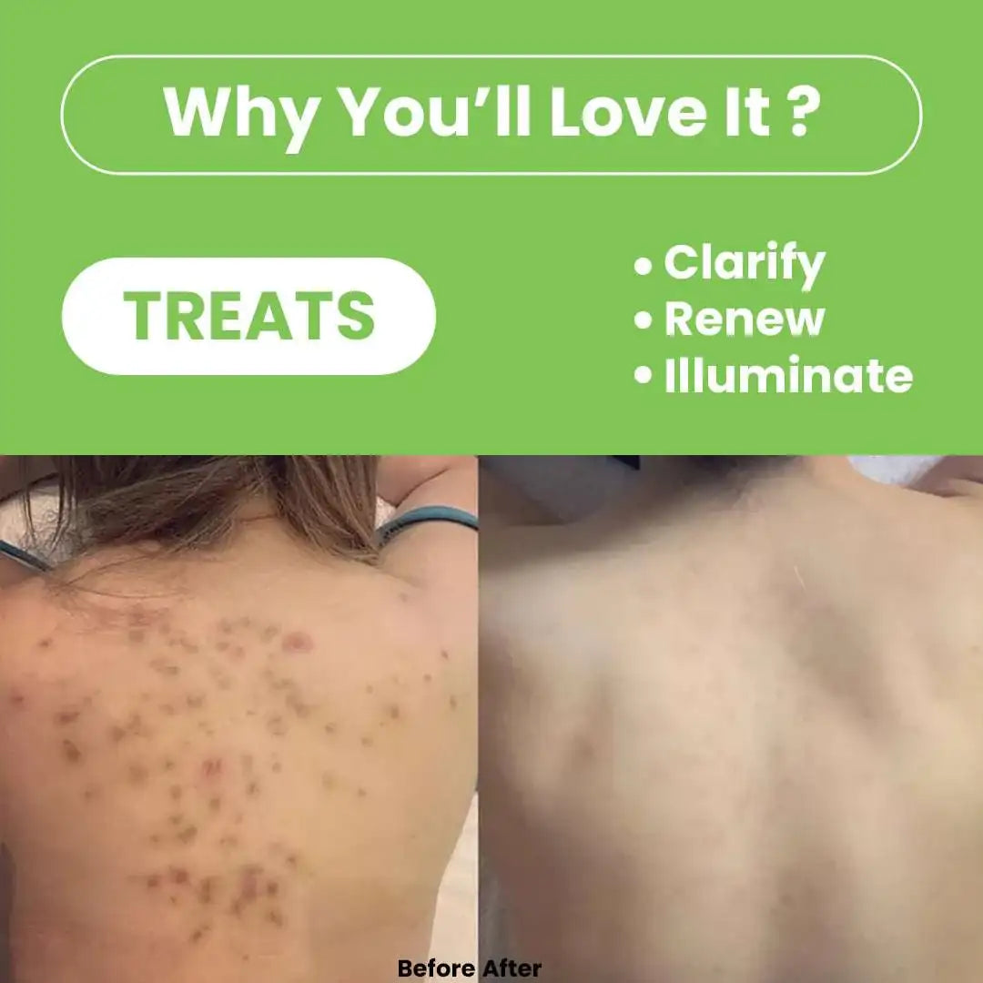 Tea Tree Combo – Clarifying &amp; Refreshing Body Care Duo