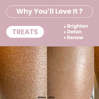 Dead Sea Mud Face &amp; Body Scrub | Lactic Acid for Detan, Exfoliation &amp; Skin Brightening | 200gm