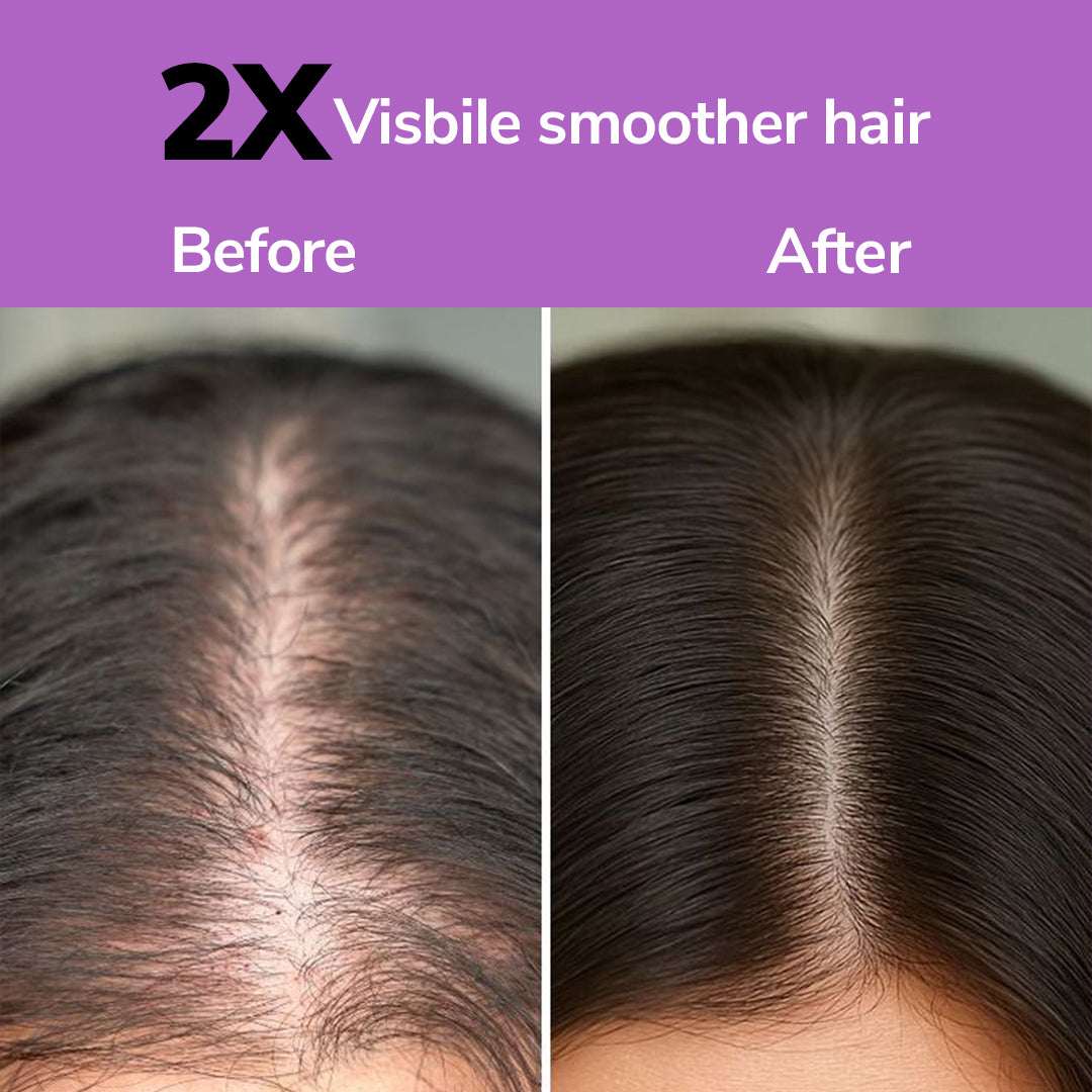 FreshLuxe Onion &amp; Rosemary Growth Boost Shampoo for Strong, Shiny Hair | 200 ml