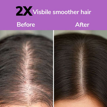 FreshLuxe Onion &amp; Rosemary Growth Boost Shampoo for Strong, Shiny Hair | 200 ml