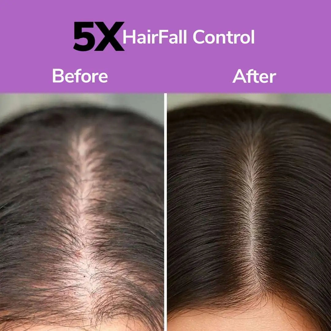 FreshLuxe Anti-Hairfall &amp; Strengthening Combo | Rice Water &amp; Onion Rosemary 200ml