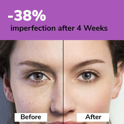 Before and after comparison of facial skin with text indicating 38% improvement after 4 weeks.