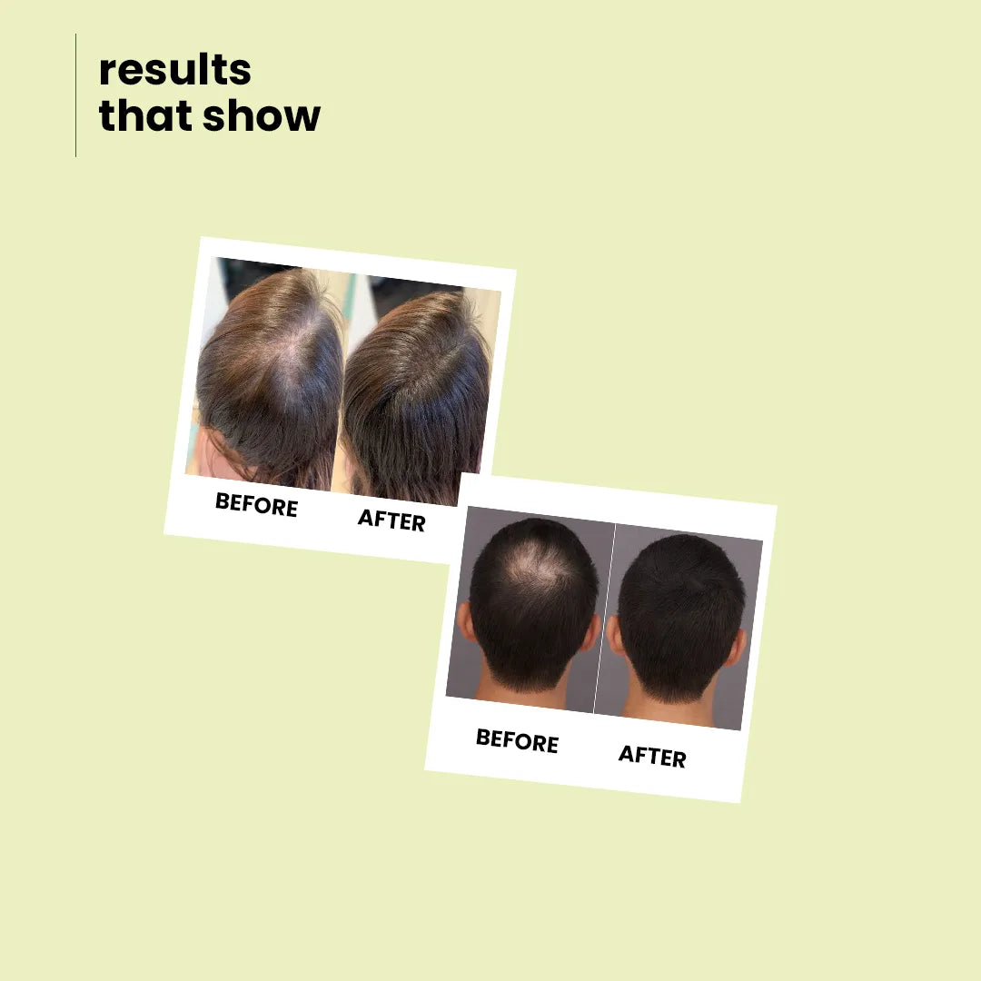 Moroccan Argan &amp; Apple Cider Shampoo |  Deep Moisturization, Smooth &amp; Lustrous Hair 200 ml