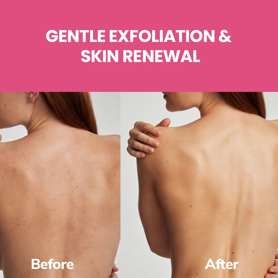 FreshLuxe Valley Whisper Body Wash | Reduces Dark Spots | Floral Scent | 200 ml | 400 ml