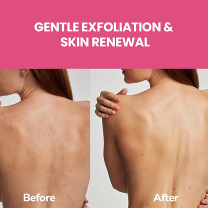 FreshLuxe Valley Whisper Body Wash | Reduces Dark Spots | Floral Scent | 200 ml | 400 ml