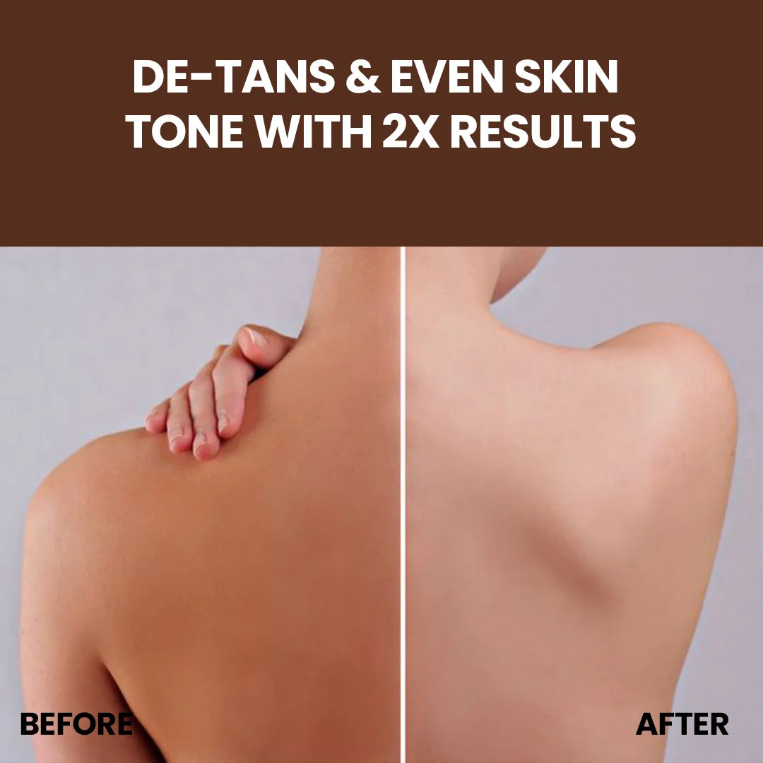 FreshLuxe Wood Myst Body Wash | Reduces Uneven Skin Tone &amp; Dullness | Vanilla Scent | 200 ml | 400 ml