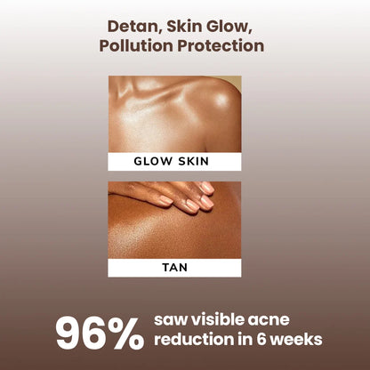 FreshLuxe Wood Myst Body Wash | Reduces Uneven Skin Tone &amp; Dullness | Vanilla Scent | 200 ml | 400 ml